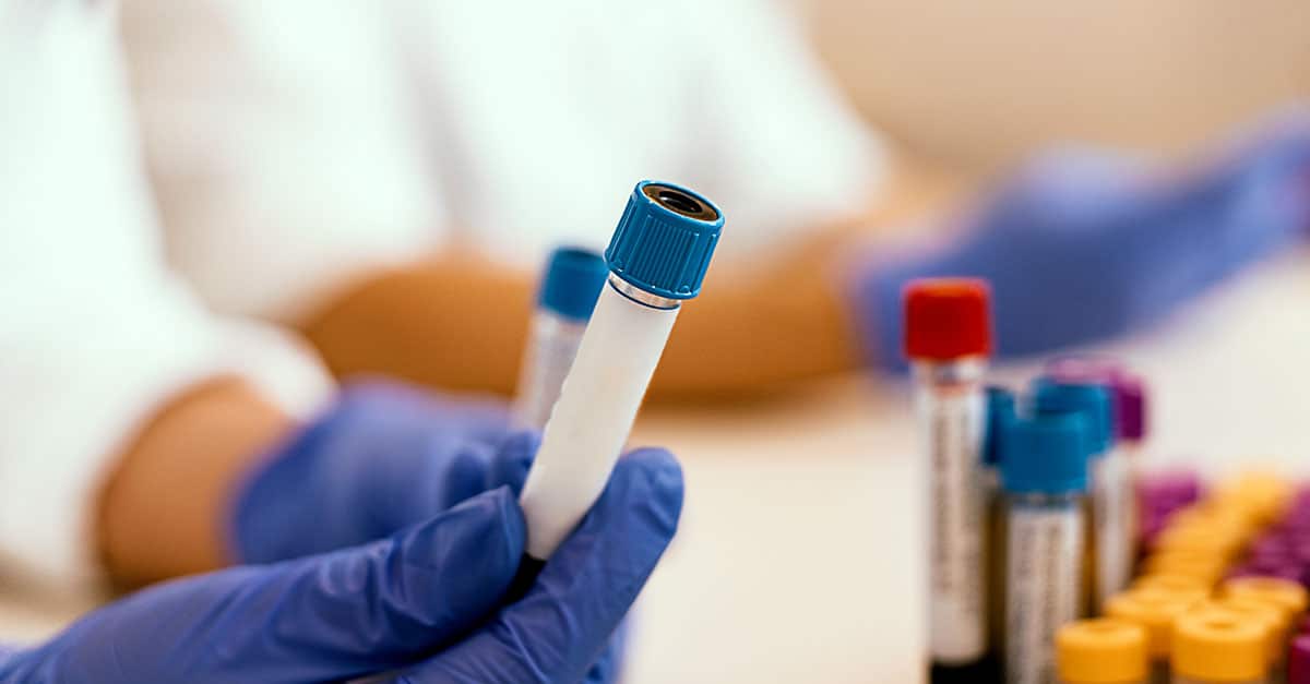 Vials of blood in lab