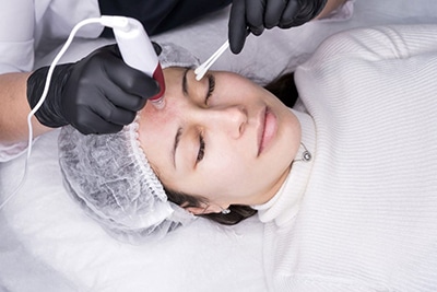 vampire facial® atlanta, image of a woman receiving a vampire facial® treatment.