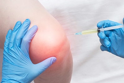 Regenerative Medicine, Medical practictioner wearing blue medical gloves inserts needle into a patient's red inflammed knee