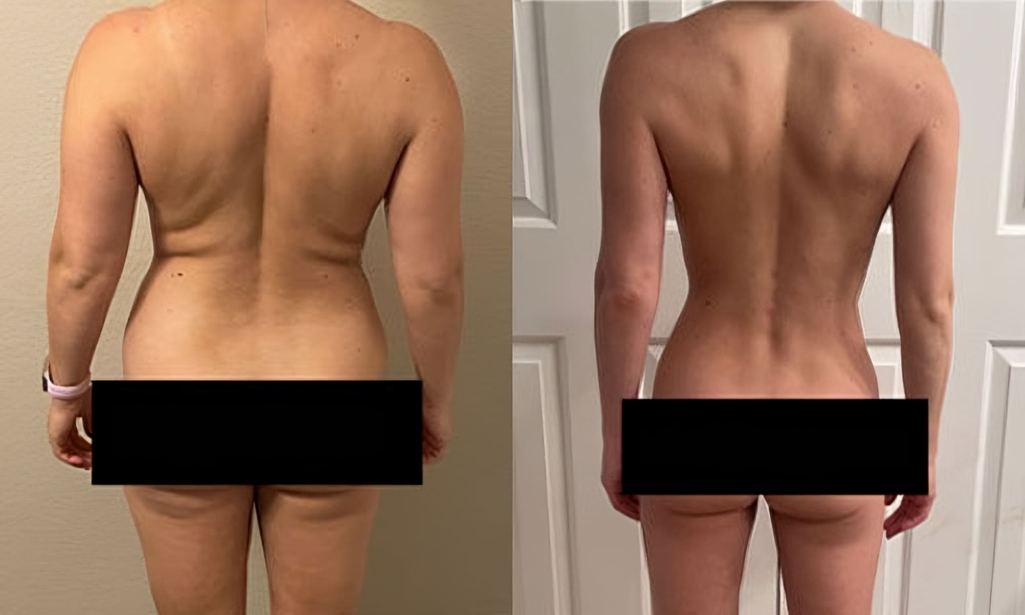 semaglutide before and after pictures, image of Patient B: a woman standing, facing away from the camera, her previous body shown on the left and her current body on the right.