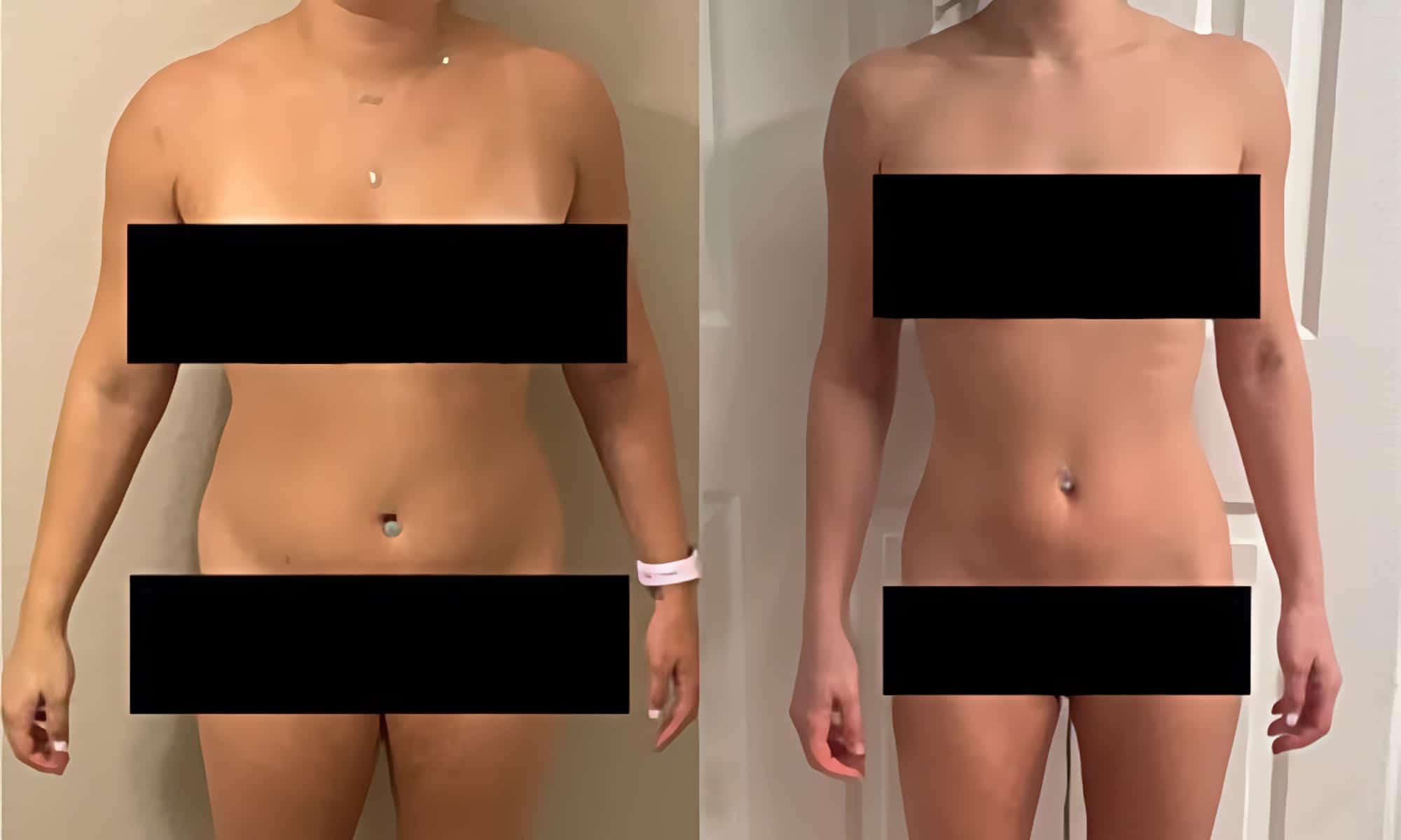 semaglutide before and after pictures, image of Patient B: a woman standing, facing the camera, her previous body shown on the left and her current body on the right.