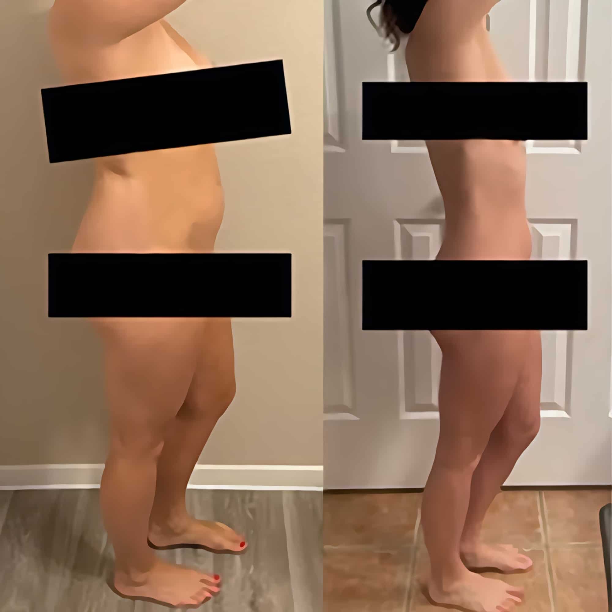 semaglutide before and after pictures, image of Patient B: a woman standing, facing left, her previous body shown on the left and her current body on the right.