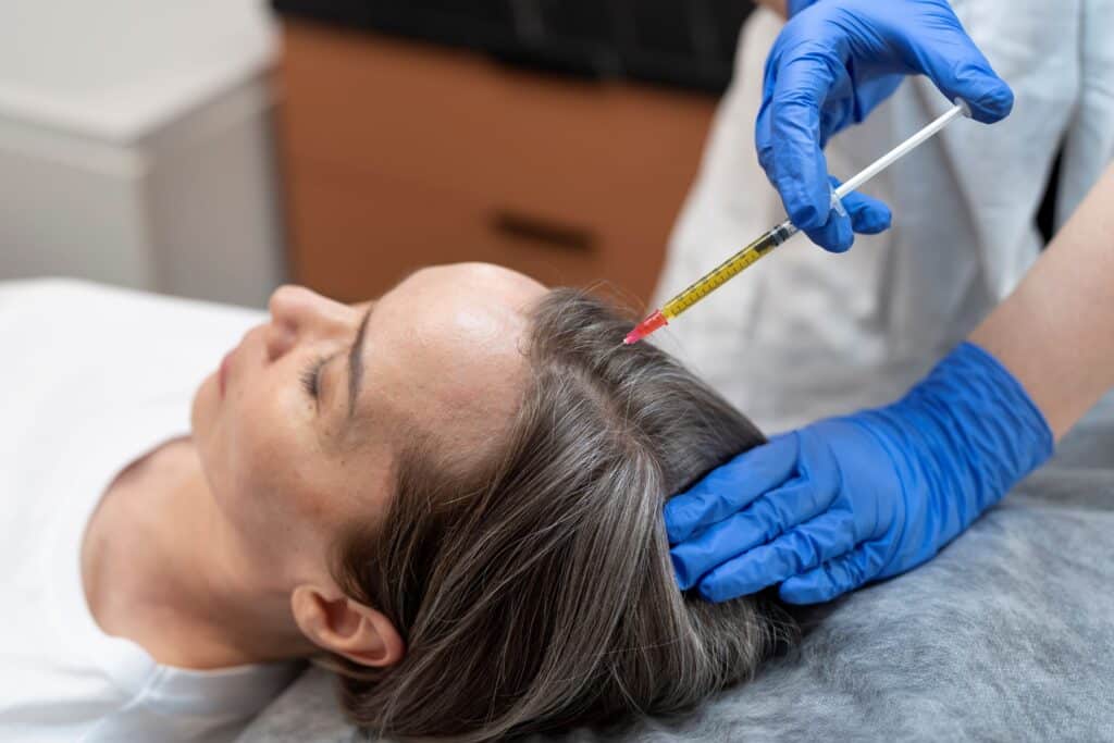 PRP hair treatment, Image of a doctor inserting an injection into a woman patient’s hairline.