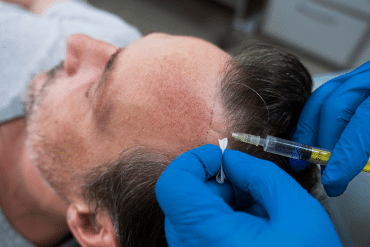 Image of a man receiving PRP injection for hair restoration.