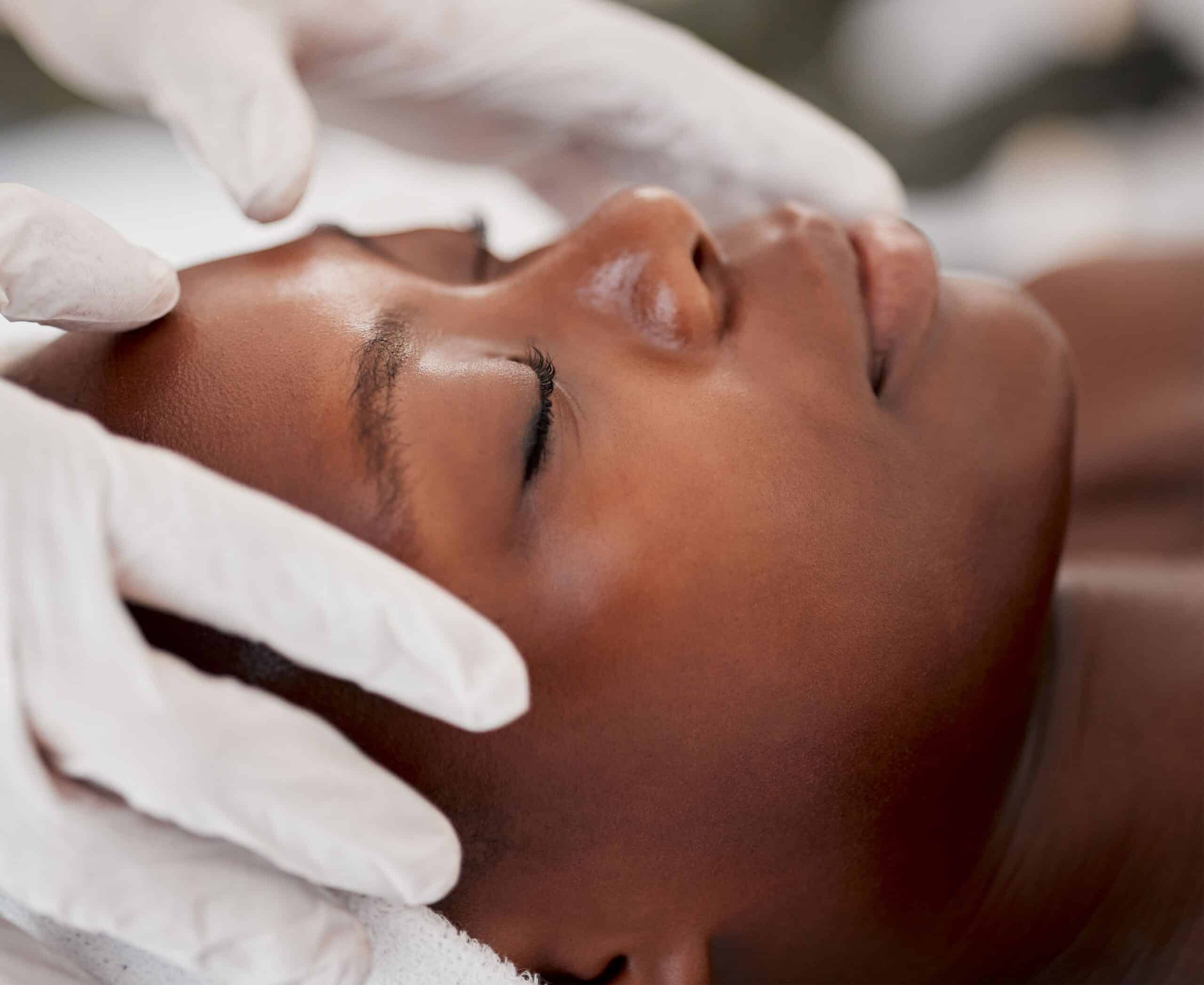 What is a Vampire Facial®, image of a woman lying down with her eyes closed and a doctor’s gloved hands on her face.
