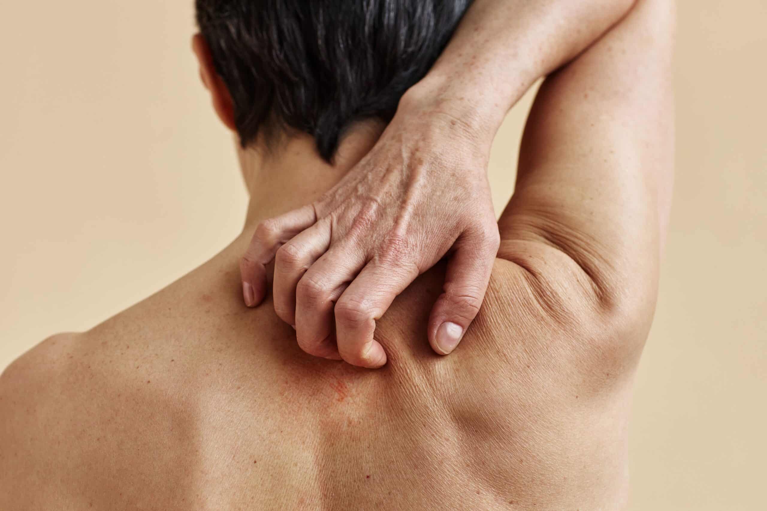 Can Adhesions Cause Back Pain, image of a shirtless man grasping the back of his upper back with his right hand.
