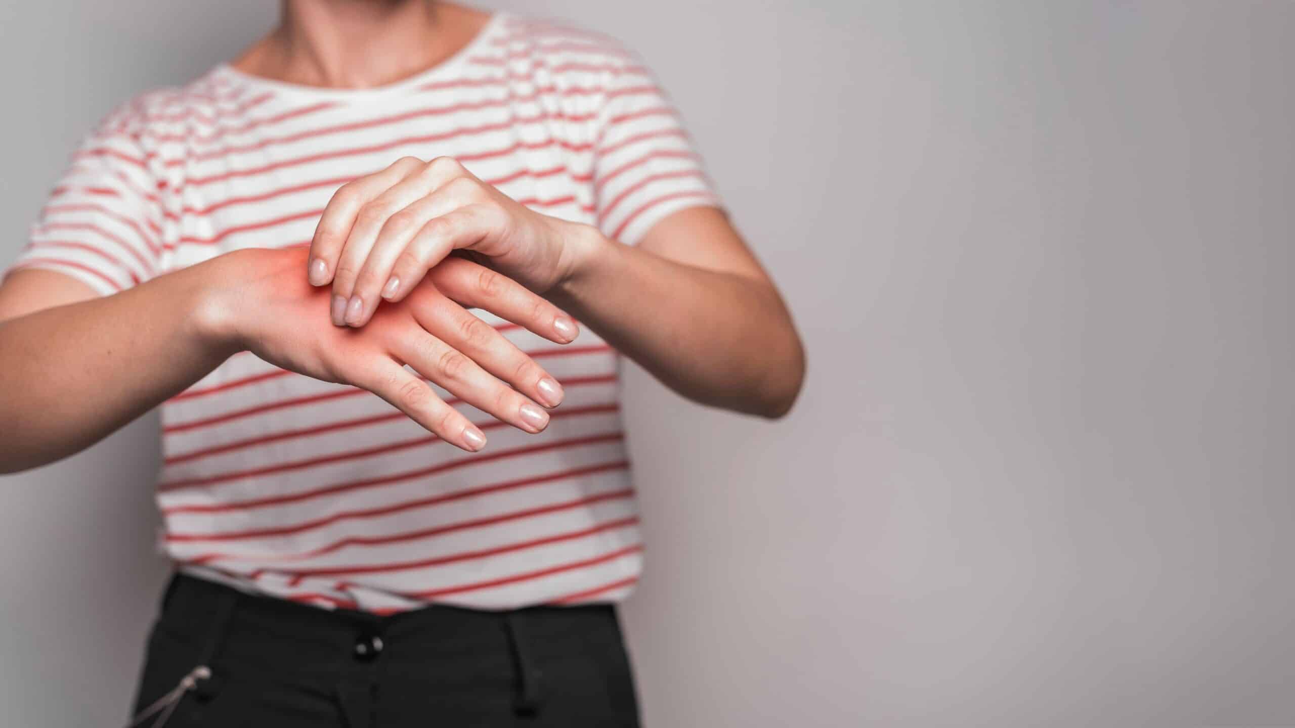 Stages of Inflammation, image of a woman wearing a white and red stripe t-shirt and black jeans grasps her inflamed right hand.